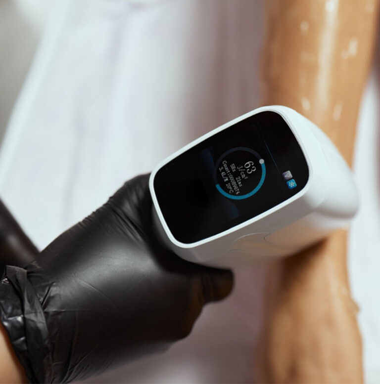 Dark Skin Tones Laser Hair Removal Services in Cambridge, MA