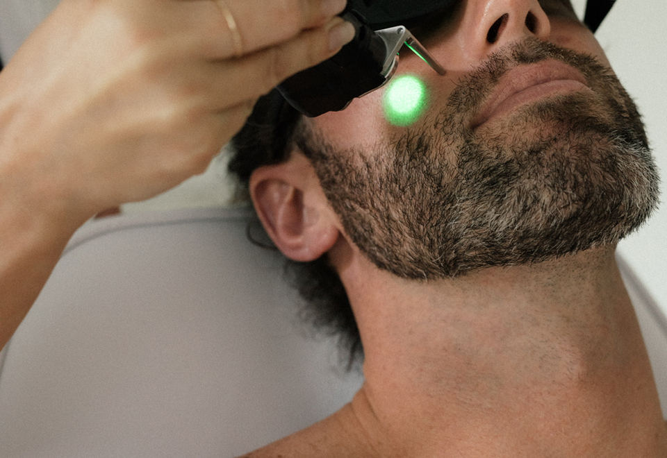 men laser hair removal