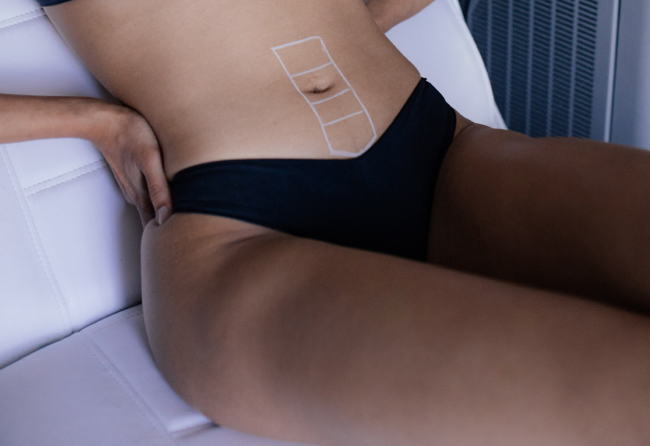 brazilian area laser hair removal brazilian area laser hair removal