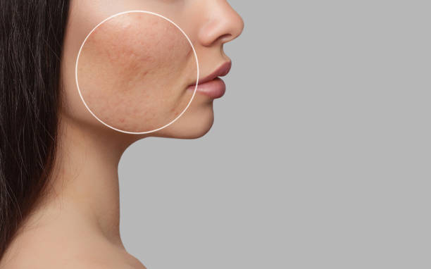 Skin condition diagnosis