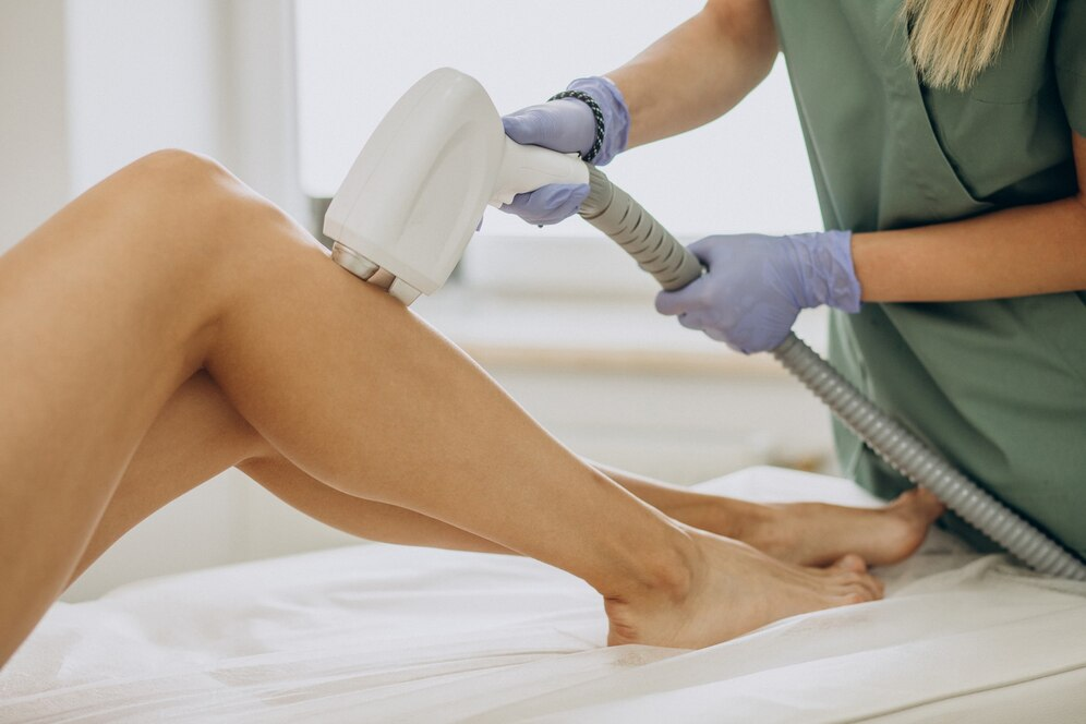 Laser hair removal on legs